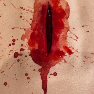 Chest penetrating stab wound